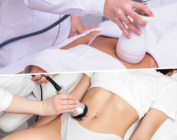 soin lipocavitation radiofrequence