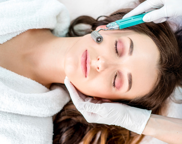 microneedling